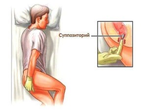 Введение ректальных свечей