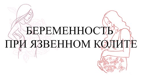 Беременность при язвенном колите