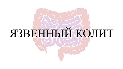 Язвенный колит vzkfarm